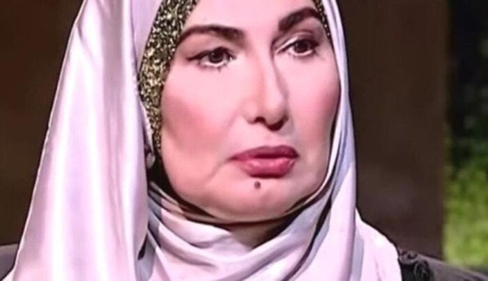 إصابة الفنانة جميلة عزيز بقطع في شبكية العين اليسرى